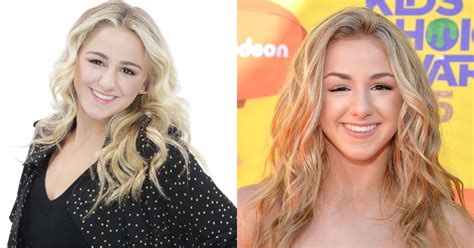 chloe lukasiak eyes|Chloe Lukasiak eye condition.